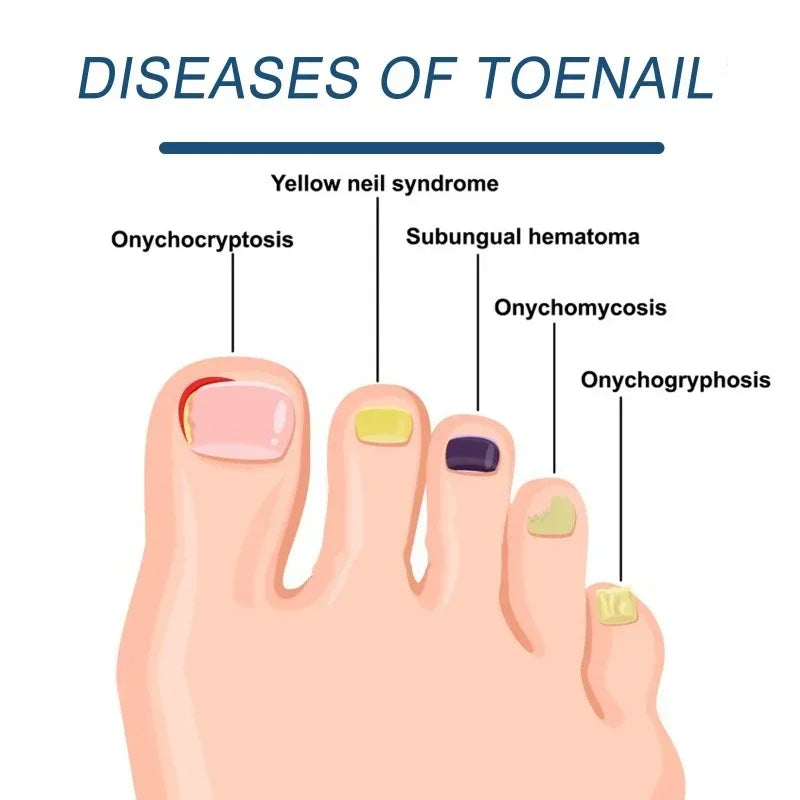 Foot toenail tool brush nail beauty care&nail rejuvenation, Giving you brand new nails